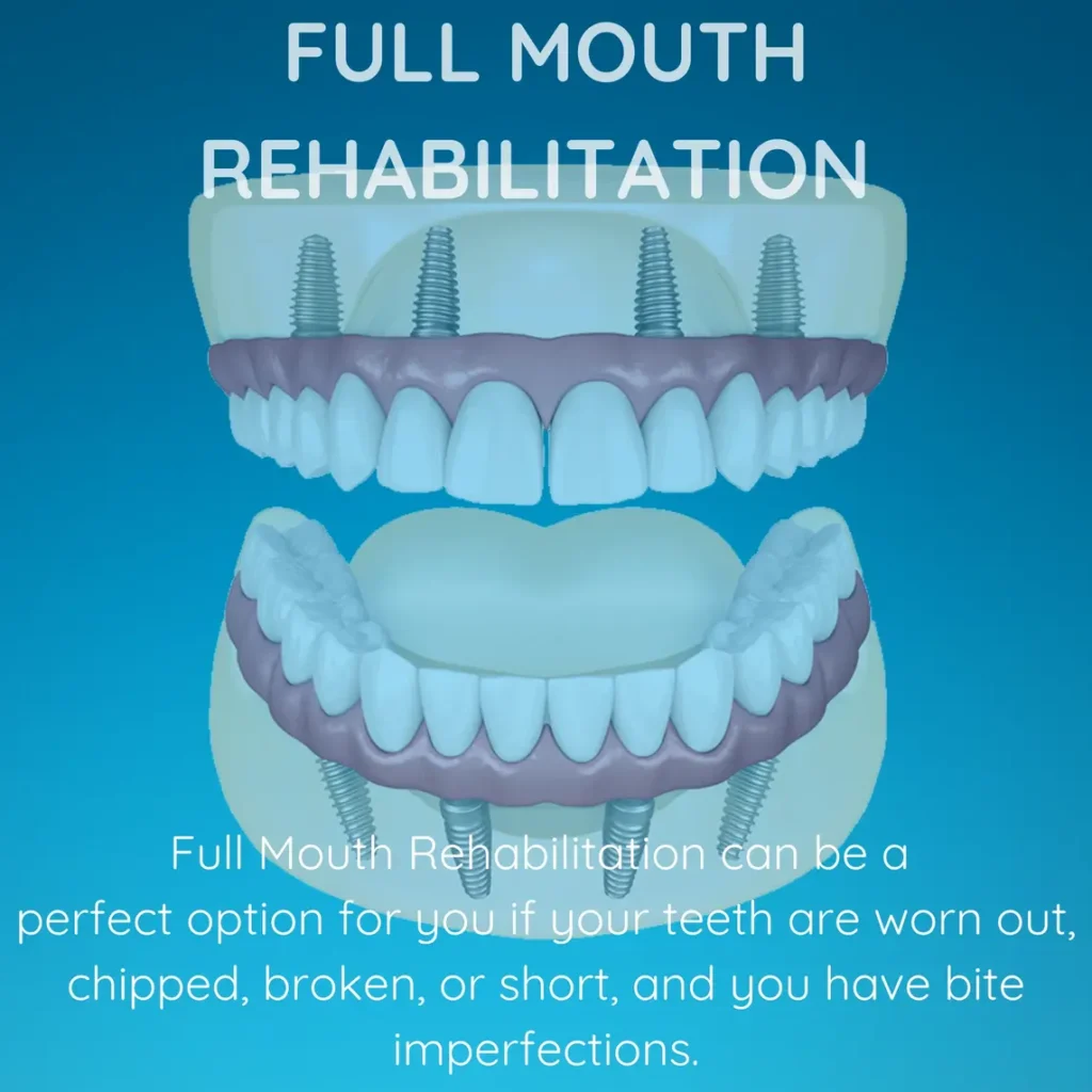 Horizon Implants Thousand Oaks California - USA