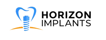 Most Affordable Dental Implants Clinic in Thousand Oaks, CA