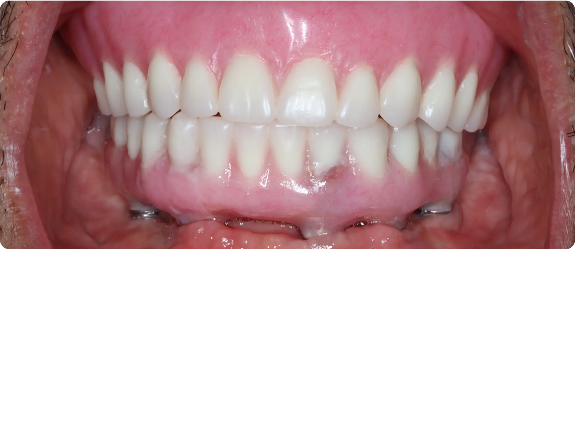 After image