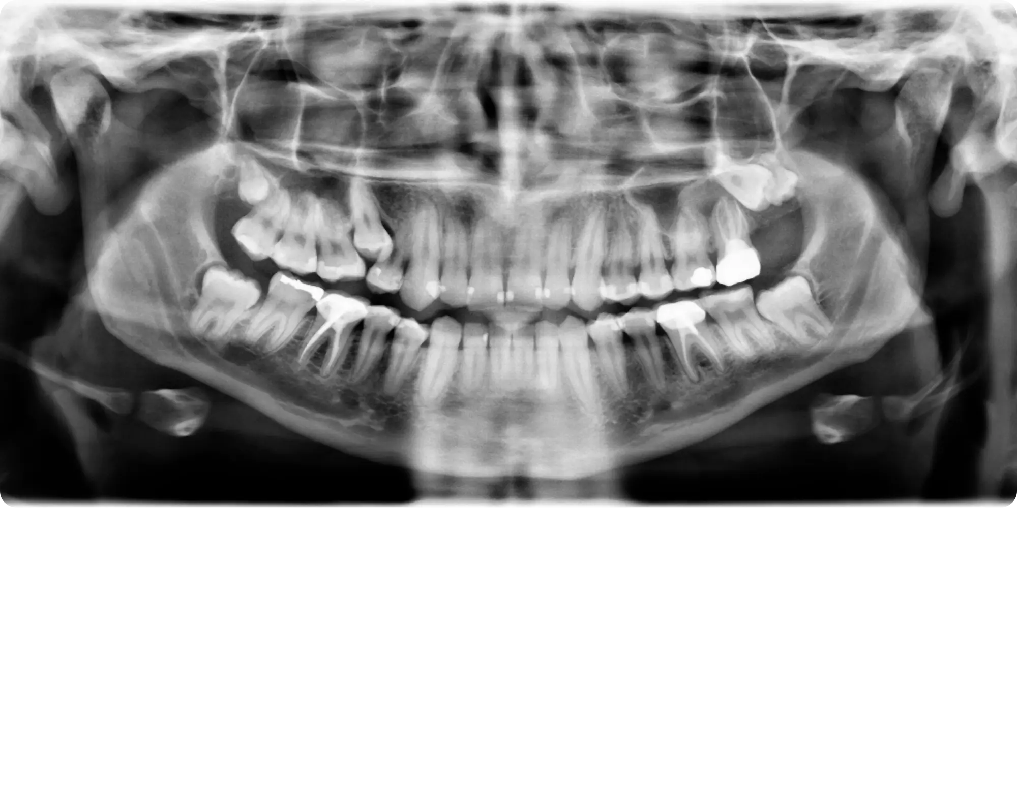 Before image