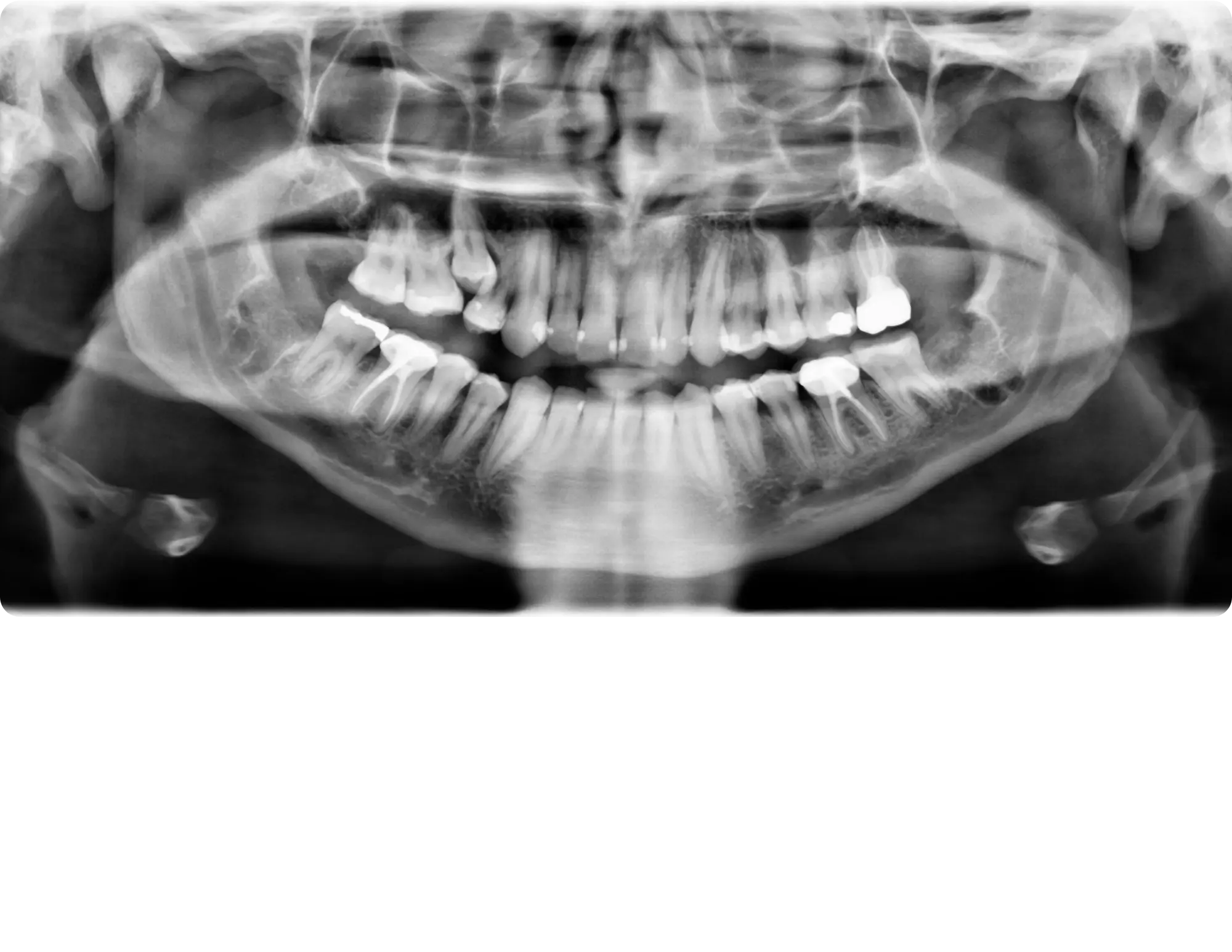 After image