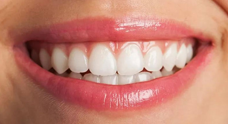 Straight teeth after clear aligner treatment in Oakland, CA