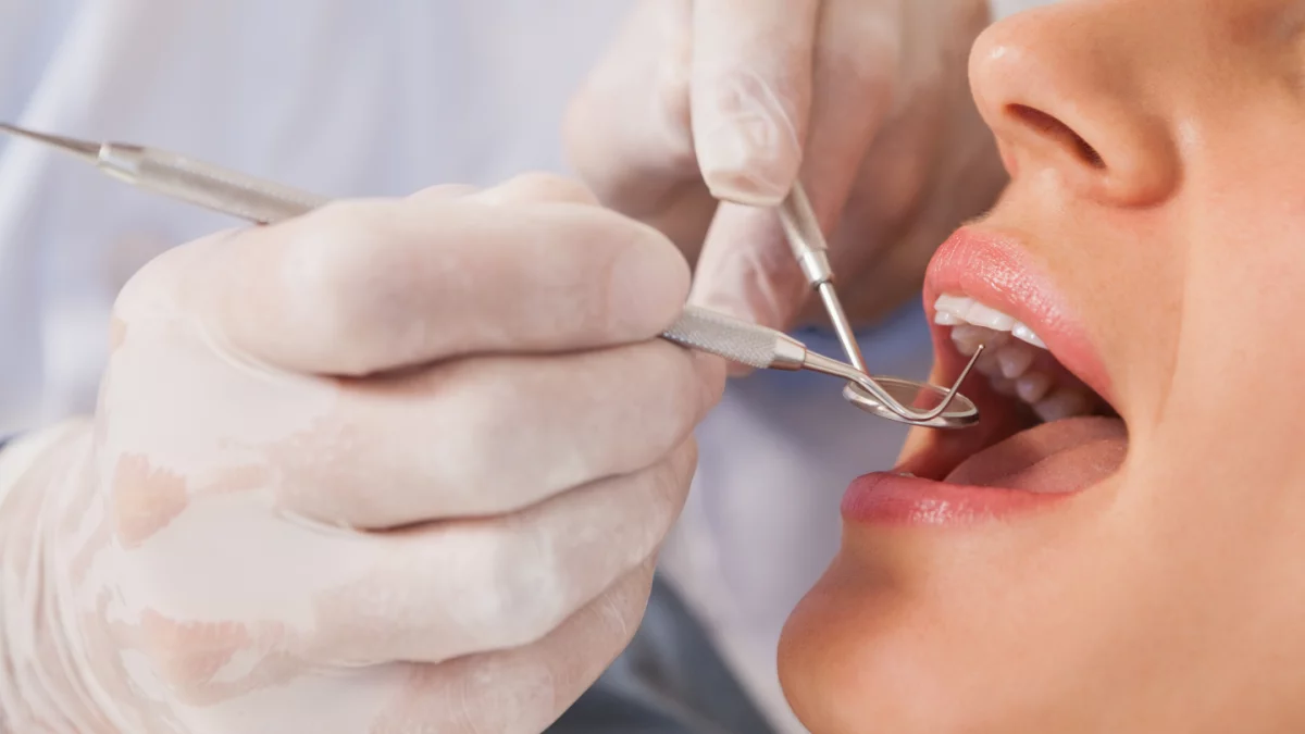 Restored teeth after dental crown treatment in Oakland, CA